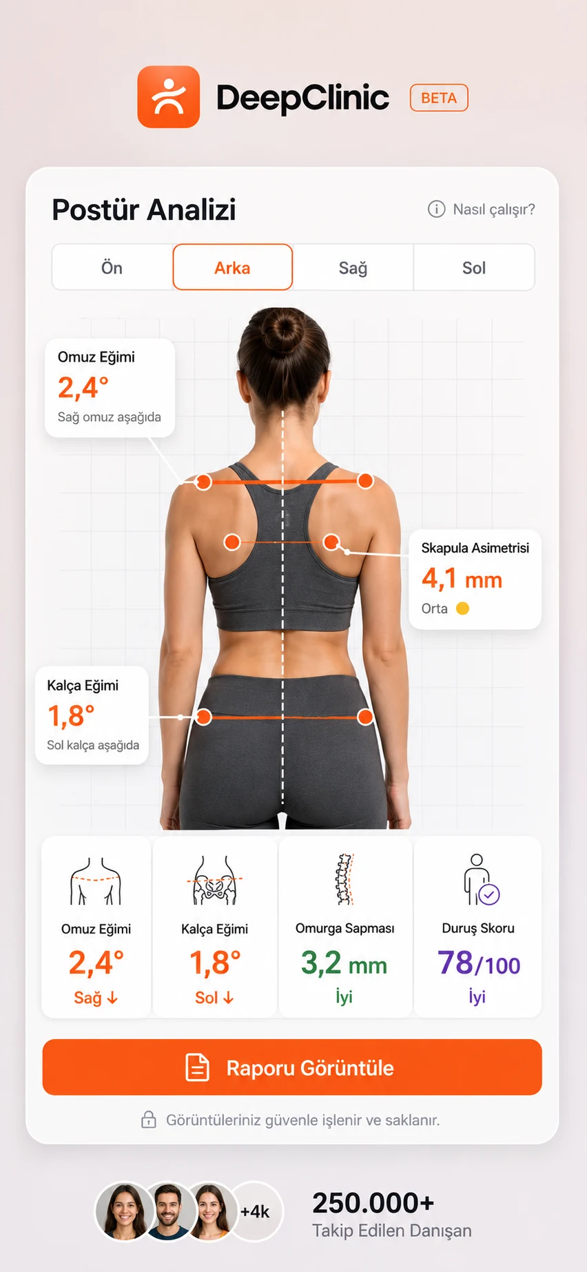 DeepClinic postür analizi — fotoğraf üzerinde açı ölçümleri